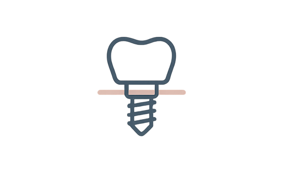 Implante - icone - site.png
